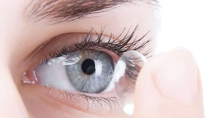 The optical method of vision correction is the use of contact lenses. 