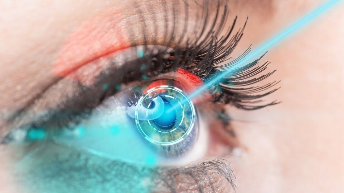 Restoration of vision with laser correction